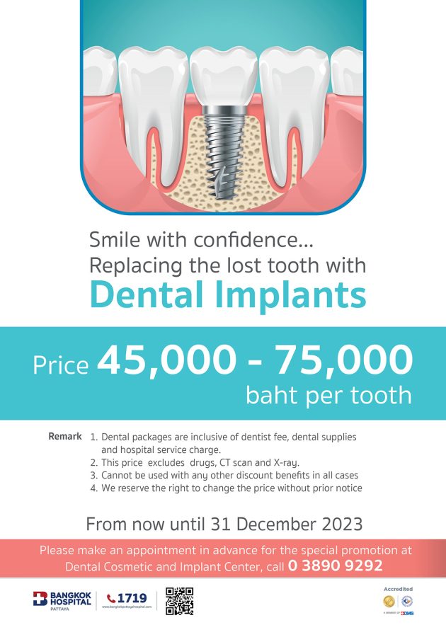 Dental_Implant22_EN-630x890.jpg