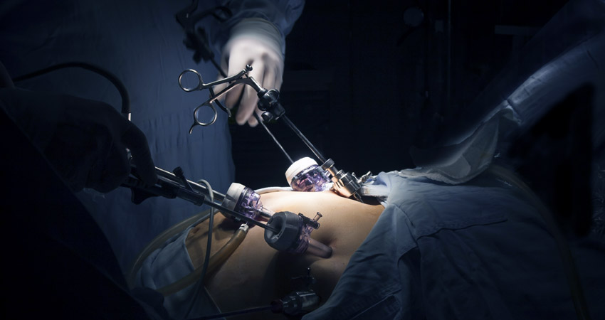laparoscopy surgery2