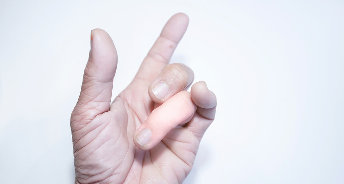 Bangkok-Pattaya-Hospital-disease-treatment-นิ้วล๊อค-(Trigger-Finger)