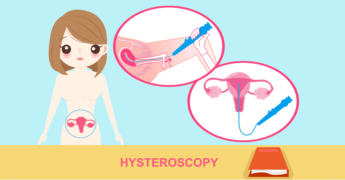 gyn hysteroscopy