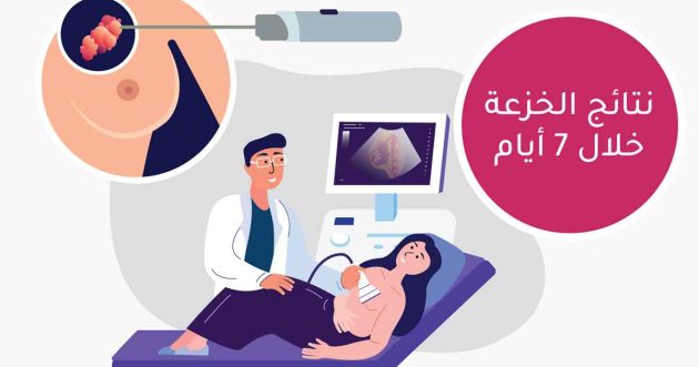 خزعة الموجهة